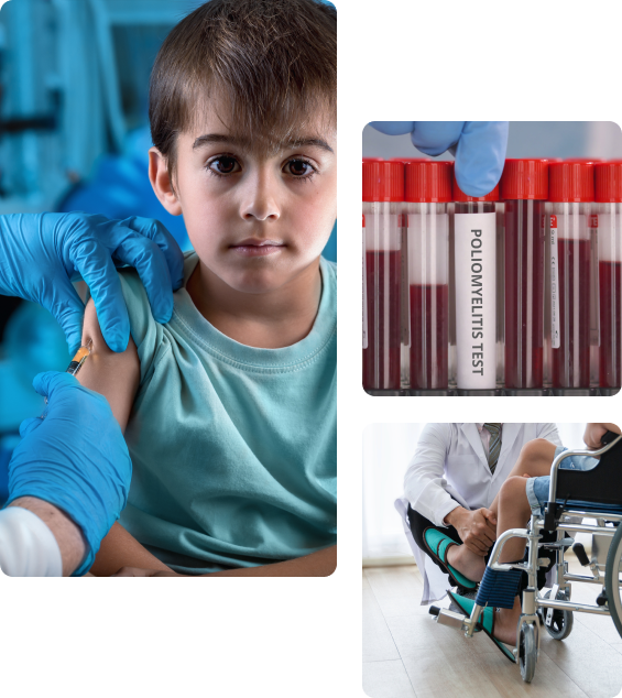 Последствия у детей после прививки от полиомиелита Последствия у детей после прививки от полиомиелита