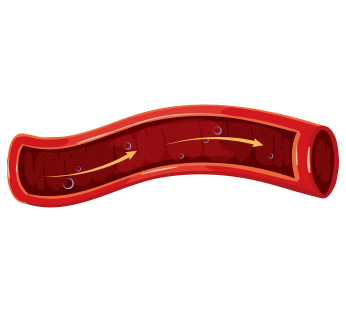 УЗИ сосудов УЗИ сосудов