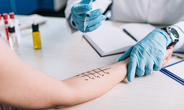 Внутрикожное введение (титрование), 1 аллерген Внутрикожное введение (титрование), 1 аллерген