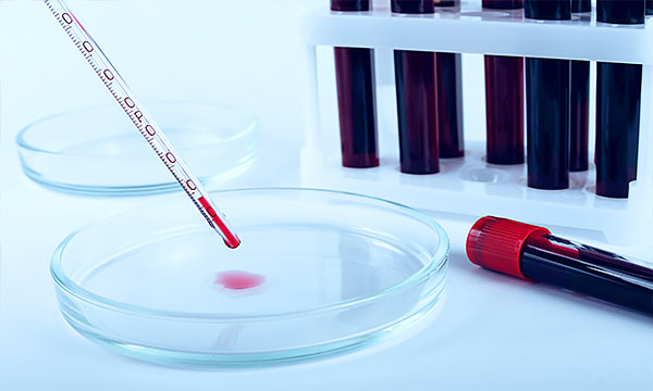 Общий анализ крови Общий анализ крови