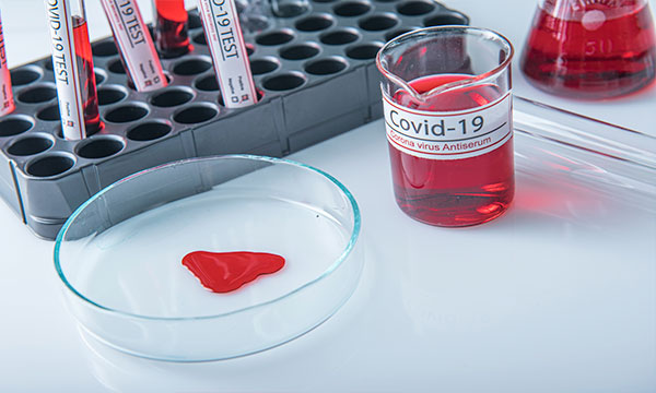 ПЦР-тест на коронавирус на дому ПЦР-тест на коронавирус на дому