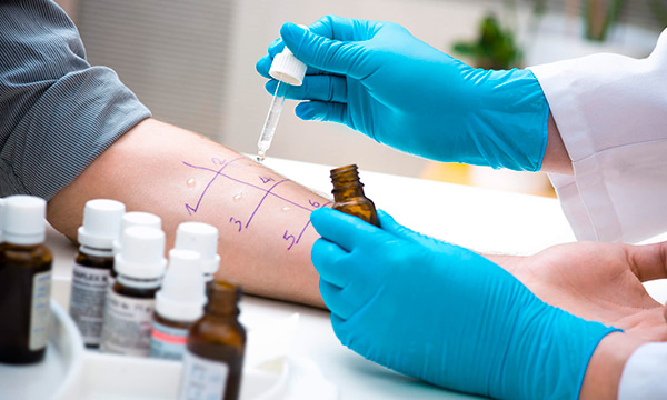 Антитела IgE к аллергену Яйца, f245 (ImmunoCAP) Антитела IgE к аллергену Яйца, f245 (ImmunoCAP)