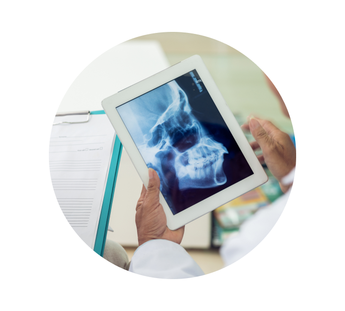 Рентген височно-нижнечелюстного сустава Рентген височно-нижнечелюстного сустава