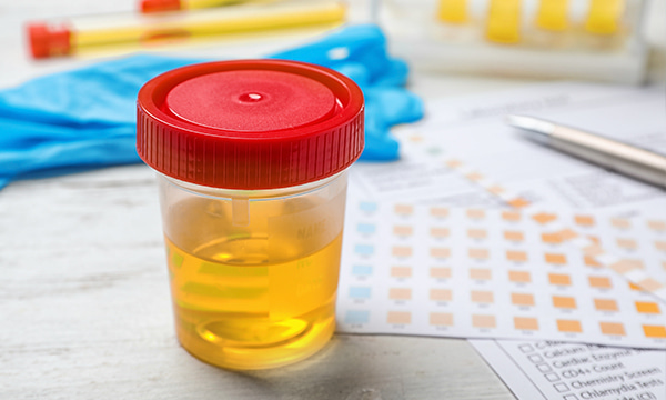 Исследование уровня магния в моче (суточная порция)