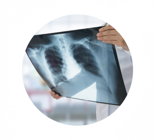 Рентген органов грудной клетки (ОГК)