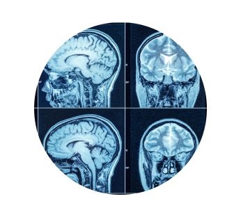 Рентген головы Рентген головы