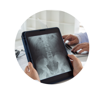 Рентген копчика