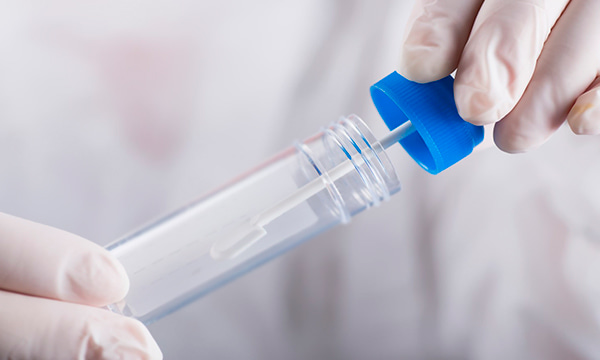 Анализ кала на скрытую кровь Анализ кала на скрытую кровь