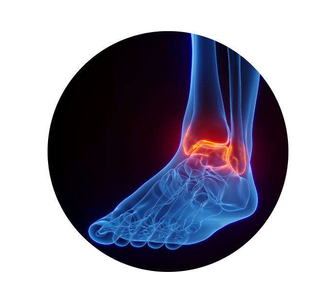 Рентген голеностопного сустава