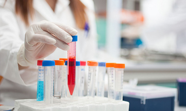 Исследование фактора некроза опухоли в сыворотке крови