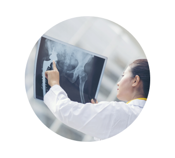 Рентген костей Рентген костей