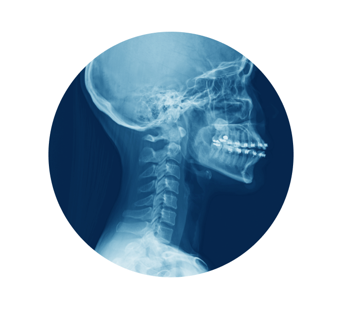 Рентген шейного отдела позвоночника