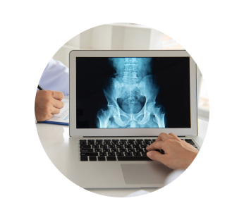 УЗИ эпителиального копчикового хода УЗИ эпителиального копчикового хода