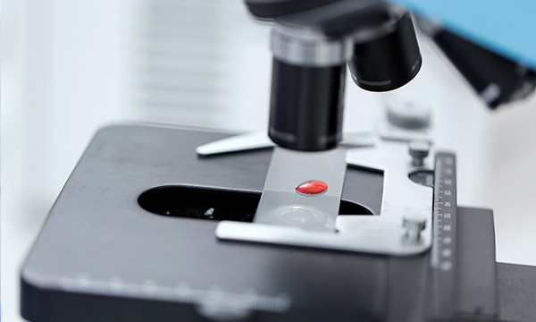 Анализ крови на лактат Анализ крови на лактат