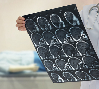 Рентген головы Рентген головы