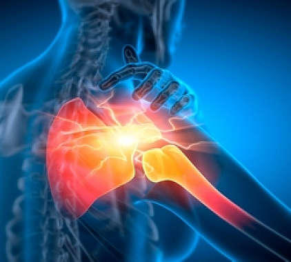 Рентген суставов Рентген суставов