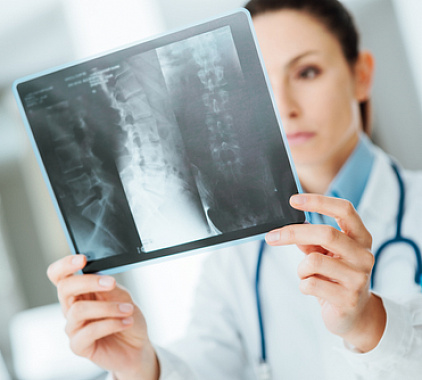 Рентген позвоночника Рентген позвоночника