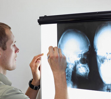 Рентген височно-нижнечелюстного сустава Рентген височно-нижнечелюстного сустава