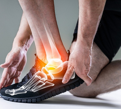 Рентген пяточной кости Рентген пяточной кости