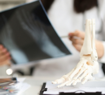 Рентген голеностопного сустава