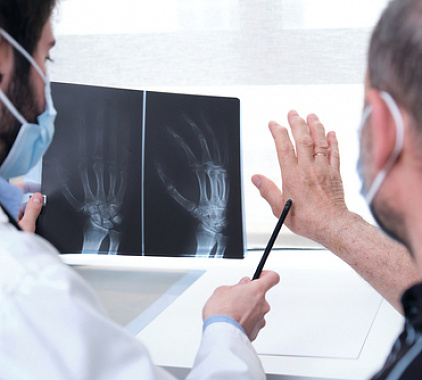 Рентген суставов Рентген суставов