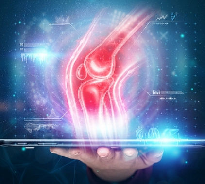 Рентген коленного сустава Рентген коленного сустава