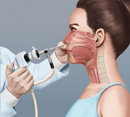 Эндоскопия носа