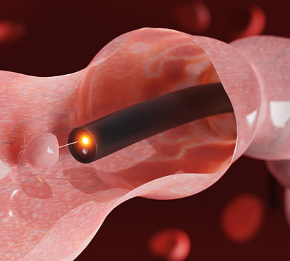 Дуоденоскопия