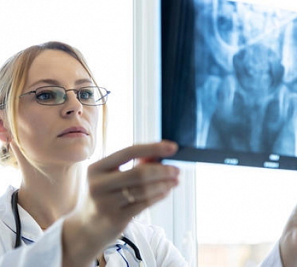 Рентген копчика