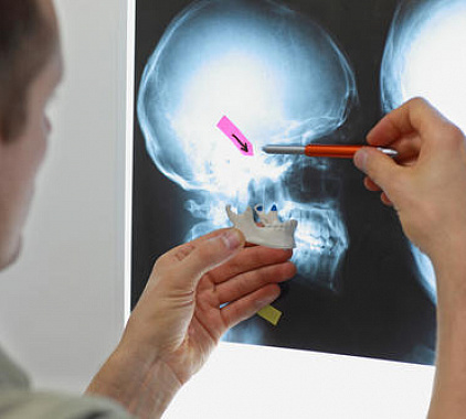 Рентген височно-нижнечелюстного сустава Рентген височно-нижнечелюстного сустава