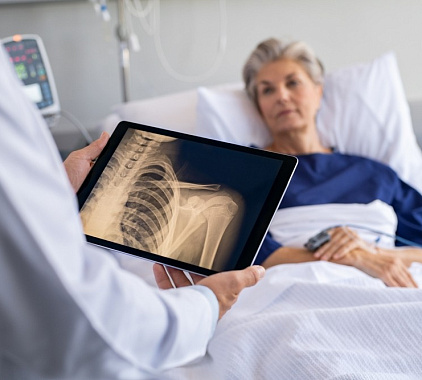 Рентген ключицы