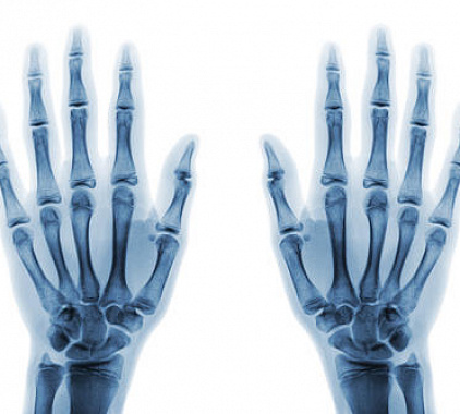 Рентген кисти