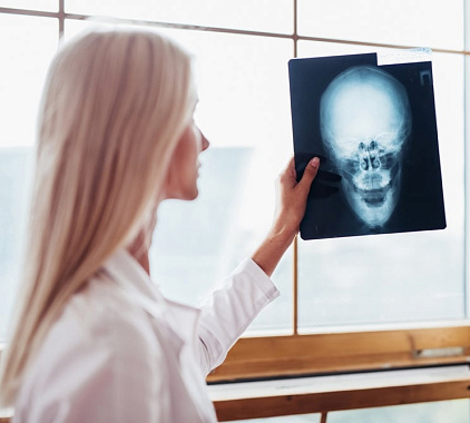 Рентген головы Рентген головы