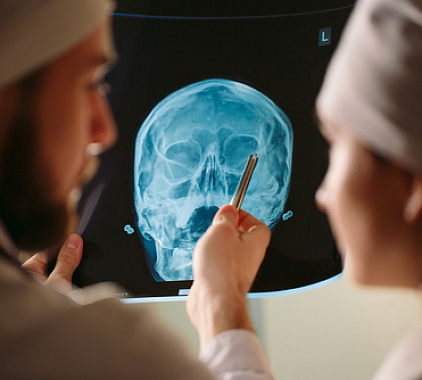 Телерентгенограмма (ТРГ) Телерентгенограмма (ТРГ)