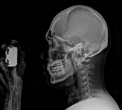 Телерентгенограмма (ТРГ) Телерентгенограмма (ТРГ)